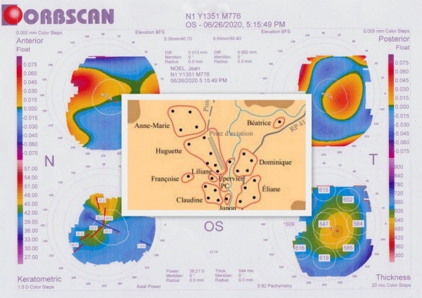 Quand Ophtalmologie Rime Avec Topographie Un Message Sur Les Voivres 88